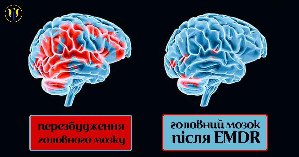 Головний мозок до і після EMDR